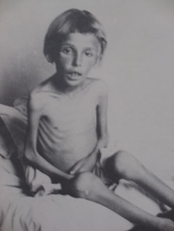 Emaciated Jewish Child
